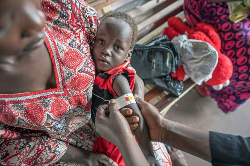 Jonglei clashes put 450,000 children at malnutrition risk—UNICEF